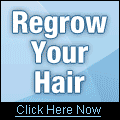 Stop Hair Loss Treatment