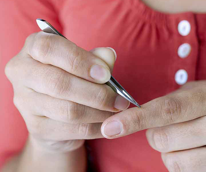 6 Ways To Remove A Splinter At Home